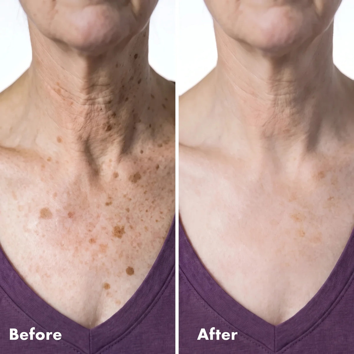 Retinol Darkspot Fading serum